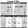 Venosan USA 20-30 mmHg Closed Toe Mid-Thigh Stocking