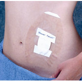 Seal-Tight Shower Patches (Set of 5)
